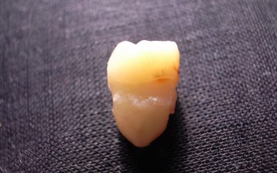 LARPBook Show Episode 61: Tooth Out